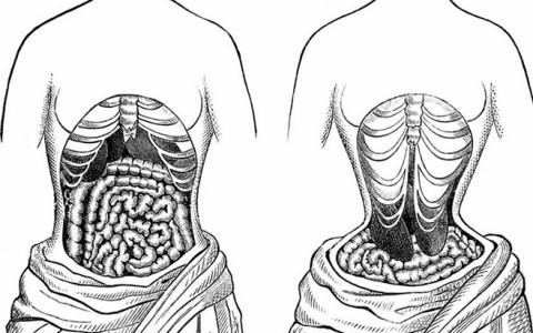 5 tác hại khi siết eo bằng đai nịt bụng